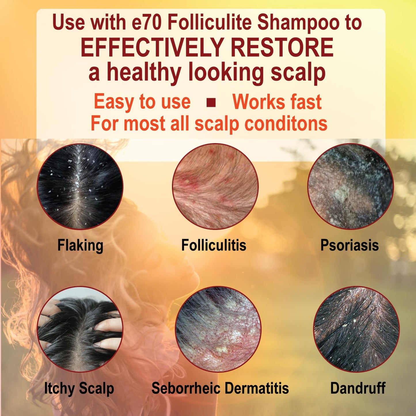 Folliculitis Treatment Conditioner with 3% BHA, Salicylic Acid, Tea Tree Oil & Chamomile Extracts - Anti Itch for women & men with Irritated Flaky Scalp Acne Treatment, Made in USA by e70, 8 fl oz